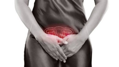 Çikolata kisti neden olur? Belirtileri nelerdir? 13