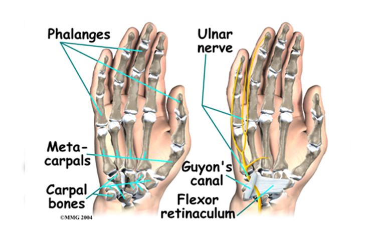 Guyon Kanalı Sendromu 8
