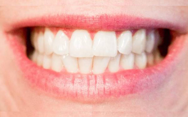 Kıskançlık dişlere zarar 1