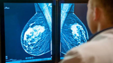 Memede şekil bozukluğu neden olur? 1