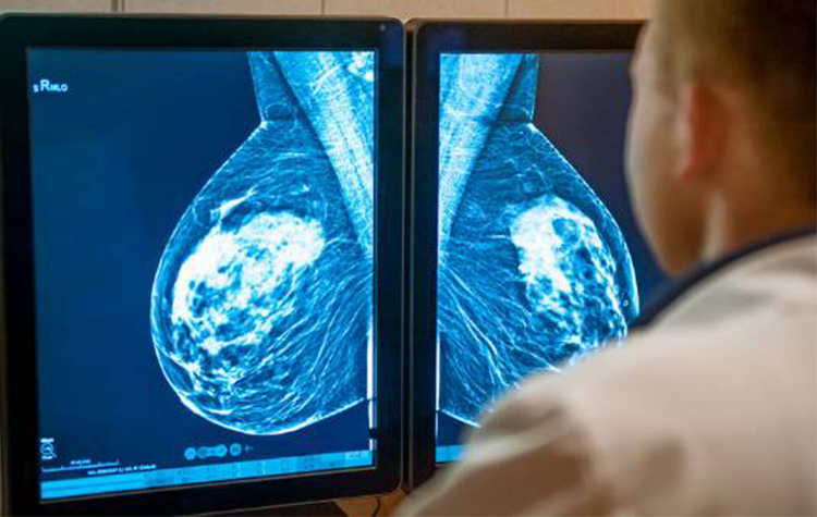 Memede şekil bozukluğu neden olur? 6