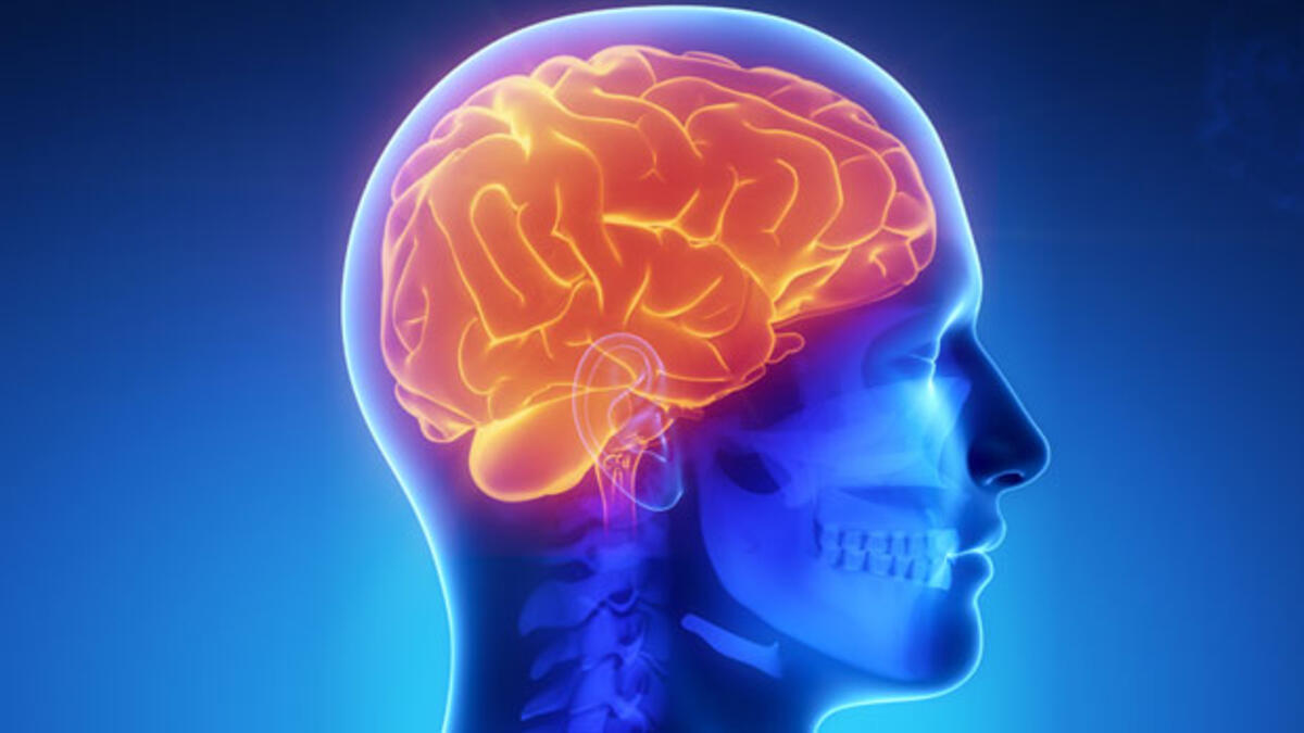 Hidrosefali (beyinde su artışı ) 8