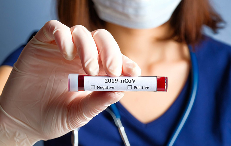 COVID-19 Hakkında Merak Edilen Sorular 6