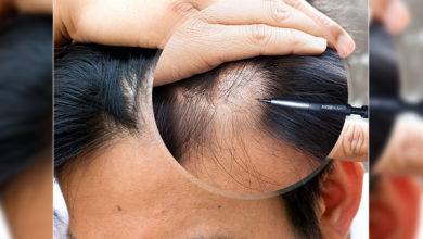 Mehmet Hanifi Kutlar: Kalem Saç Ekimi Tekniğinin Önemini Anlattı ! 1