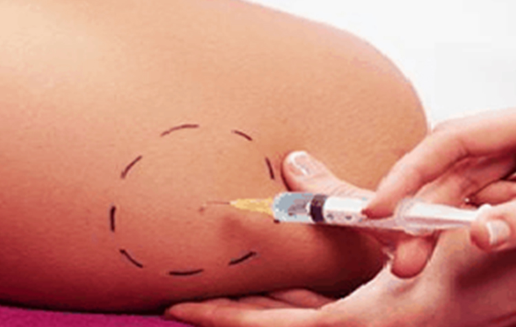 Fizik Tedavide Pek Bilinmiyor ama Faydası Saymakla Bitmiyor 7