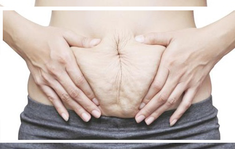 Doğum sonrası eski vücuda kavuşmak hayal değil ! 7