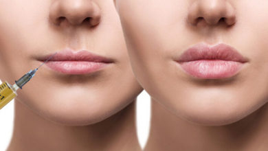 Dudak Dolgusu Yaptırırken Bunlara Dikkat ! 16