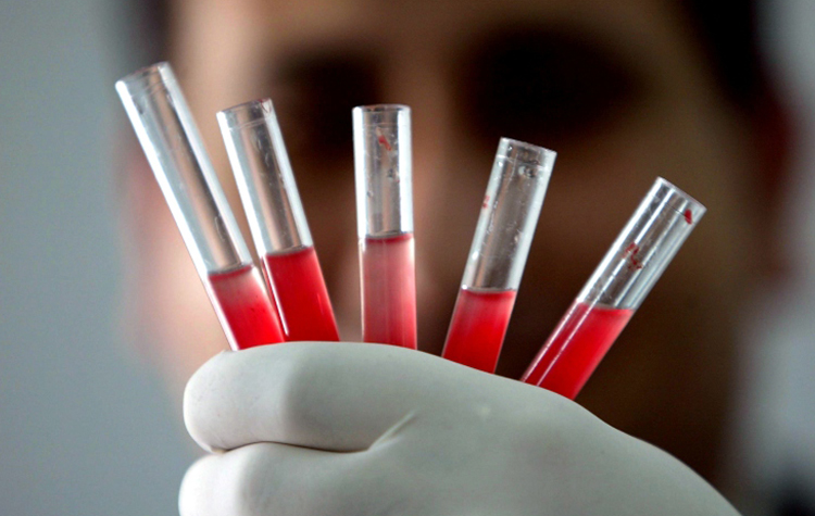 Dünyada Sadece 43 Kişide Bulunan En Nadir Kan Grubu 11