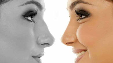 Burun Estetiğinde 10 Maddeye Dikkat 1