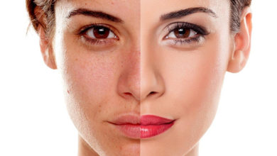 Ciltte Oluşan Problemlere Dikkat ! 10