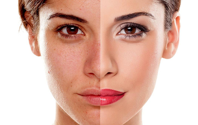 Ciltte Oluşan Problemlere Dikkat ! 7