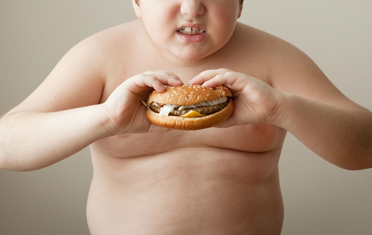 Ebeveyndeki Obezite Çocuklardaki Riski 15 Kat Artırıyor 7