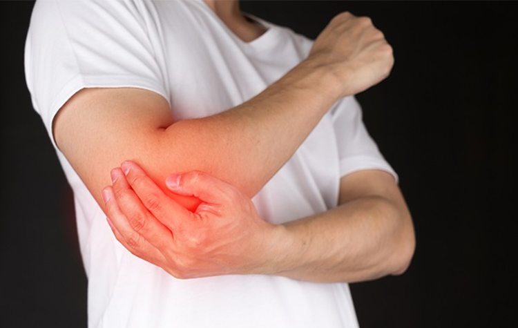 Siz Değil Ama Dirseğiniz Tenisçi Olabilir 7