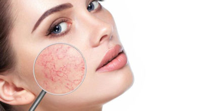 Kırışıklık ve Sarkmalara Dikkat ! 1