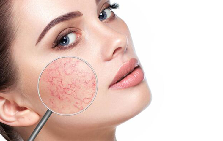 Kırışıklık ve Sarkmalara Dikkat ! 7