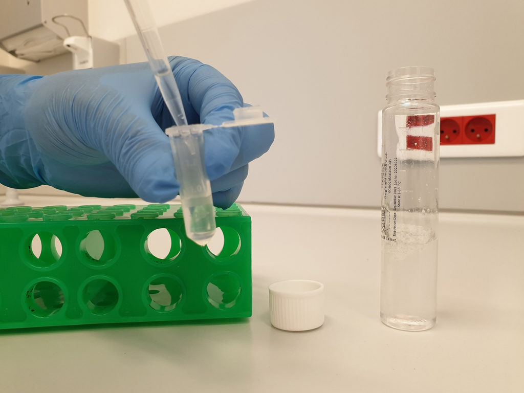 Yeni yöntem Covid-19 testlerinin duyarlılığını 20 kat artırıyor 4