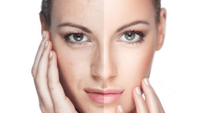 Parlak ve Sağlıklı Cilt İçin PRP Tedavisi ! 7