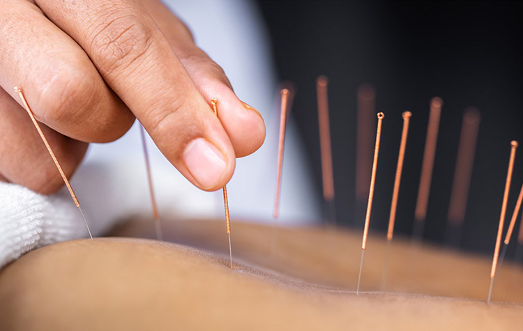 İğne Küçük ama Etkisi Büyük 7