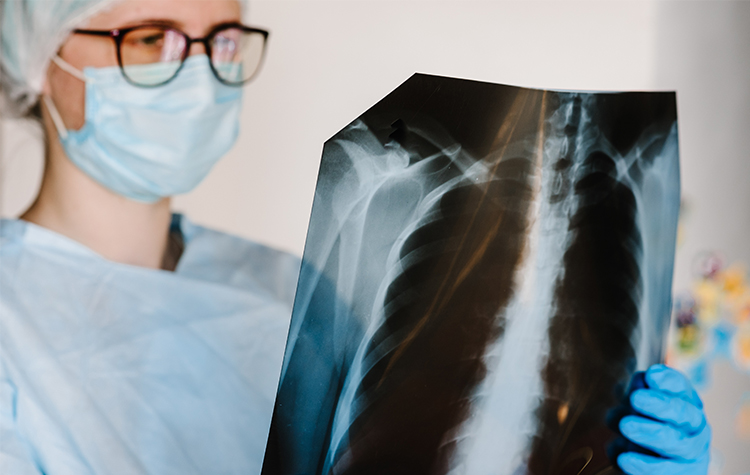 Koah hastalığı idrar kaçırma riskini artırıyor! 7