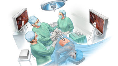 Akciğer Kanseri cerrahisinde tek ve küçük kesiden ameliyat yapılıyor! 14