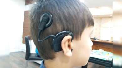 Cochlear İmplant ile 5 Yıl Sonra Yeniden Duymaya Başladı 2