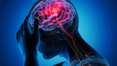 İnmeye yol açan 7 önemli neden 10