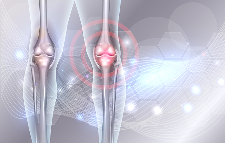 Kemik İltihabının Sebepleri Nelerdir 6