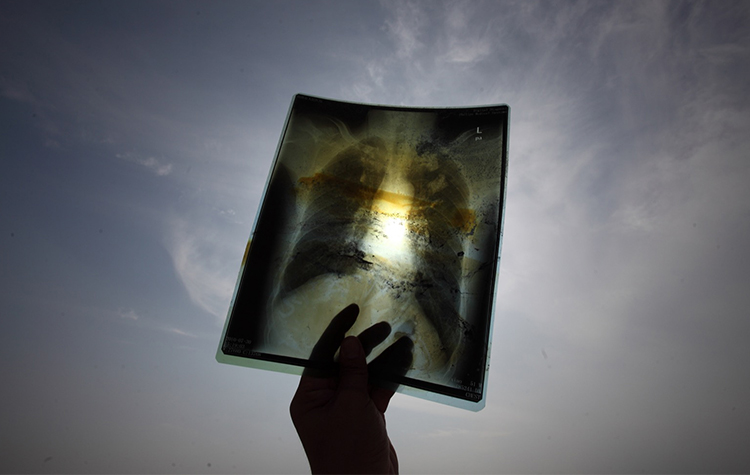 Hava kirliliği sağlık sorunlarını ciddi boyutlara taşıyor 7