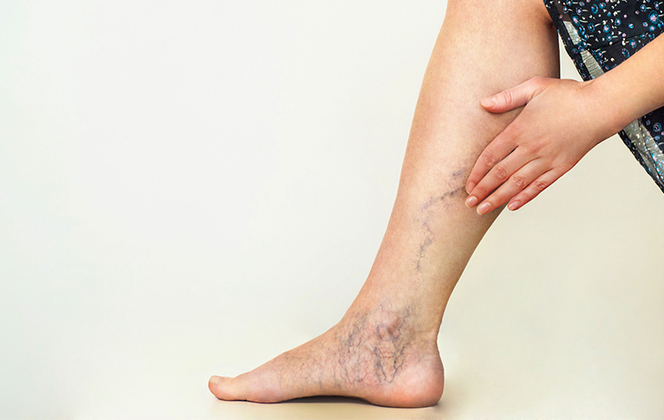 Koronadan kaçarken evdeki varis tehlikesine yakalanmayın 6