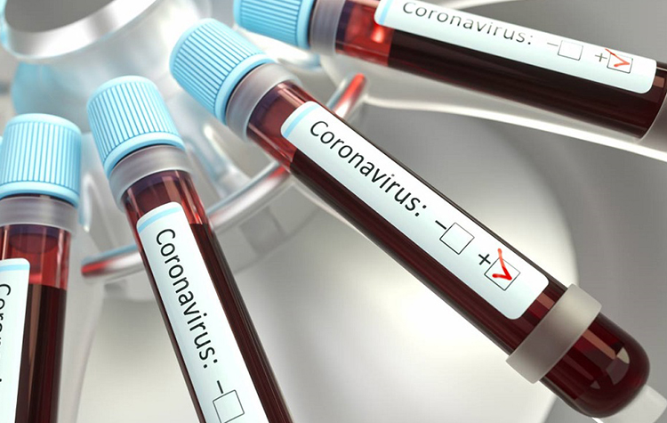 Diyabet ilacı metformin koronavirüse bağlı ölümleri önlüyor ! 7