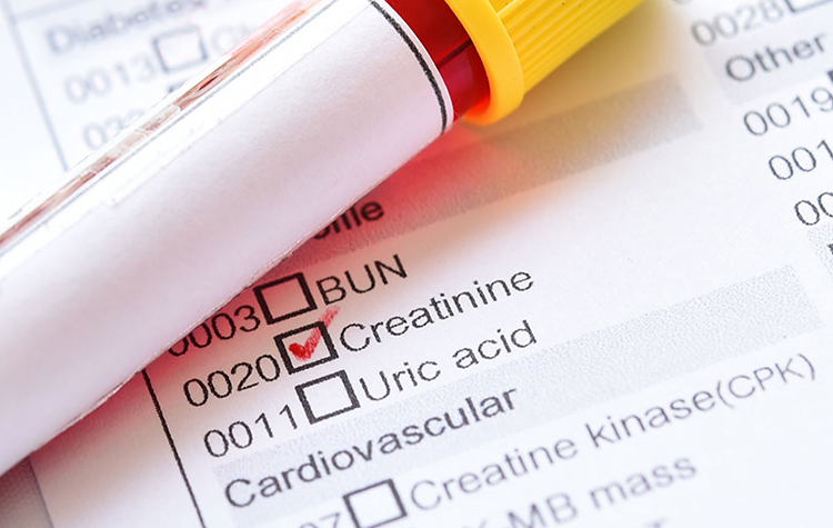 Kronik Böbrek Yetmezliği Bazı Hastalıkları Beraberinde Getiriyor 6