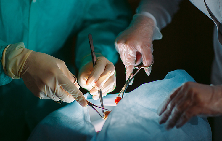 Böbrek Naklinin Aşamaları 6