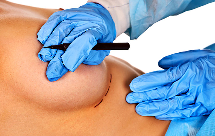 Asimetrik Göğüslere Sahip Olmak Zorunda Değilsiniz 6