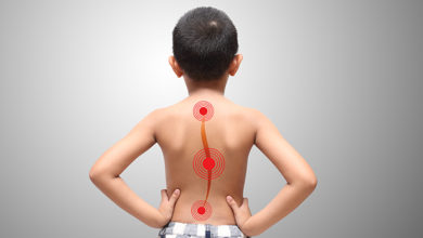 Skolyoz Tedavi Edilmezse Ne Olur? 1