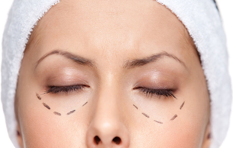 Yarım Saat İçerisinde Göz Altı Dolgunuz Tamam! 6