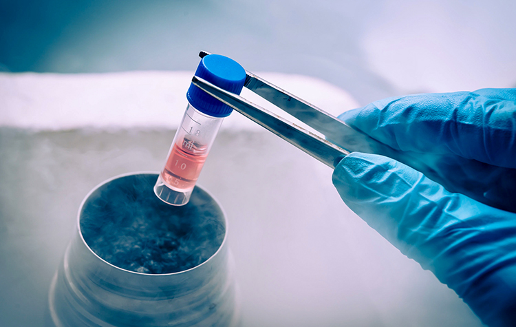 Türkiye Kök Hücre Araştırmasından Çarpıcı Sonuçlar Çıktı ! 6