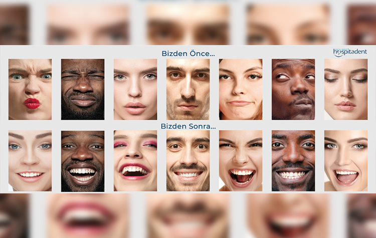 Hollywood yıldızları gibi etkileyici gülümseyin! 7