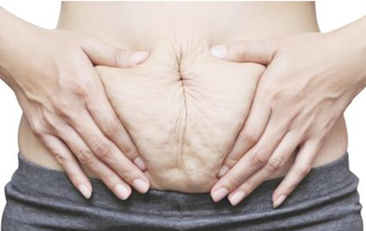 Estetiği zorunlu kılan sağlık sorunları 7