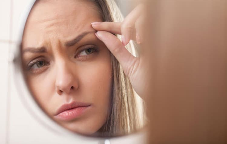 Zayıf Bağışıklık Kaşları Döküyor ! 6