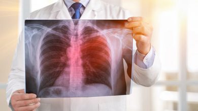 Genç doktorlar göğüs uzmanı olmak istemiyor 18