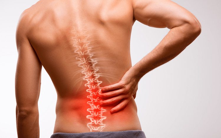 Bel Ağrıları dikkate alınmazsa ciddi Sonuçlara neden olabilir 1