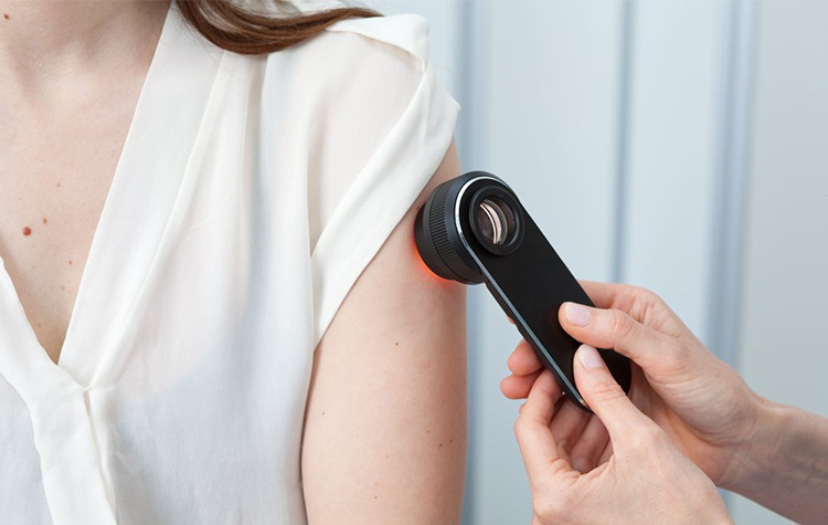 Cilt kanserine karşı koruma kalkanı oluşturarak önleminizi alın! 7