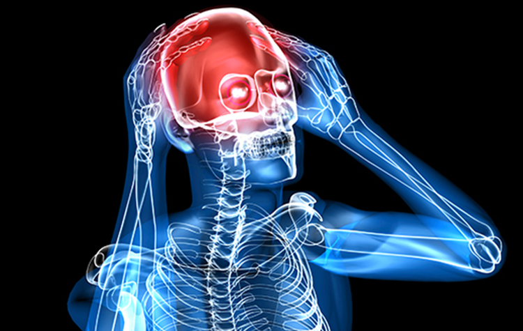 Beyin tümöründe en sık görülen 7 belirti 7