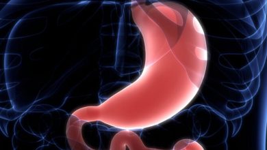 Dumping sendromunda beslenme alışkanlıkları değiştirilmeli 2