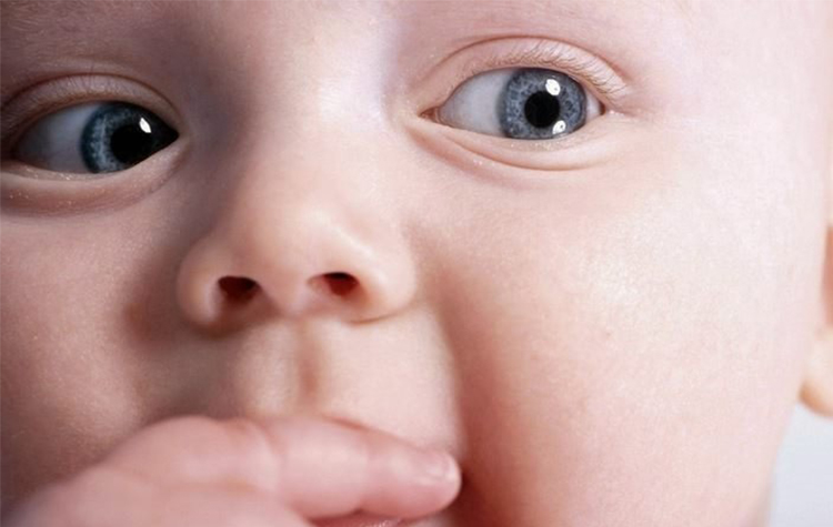 Bebekler de Göz kaymasına dikkat ! 7