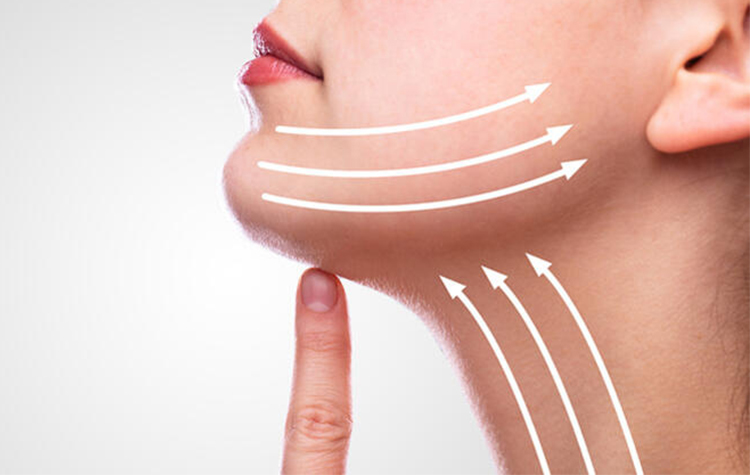 Gıdı Bölgesindeki Sarkmalara dikkat ! 7