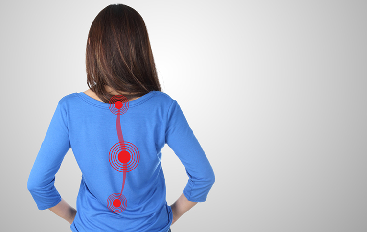 Skolyoz hakkında doğru bilinen 10 yanlış 7