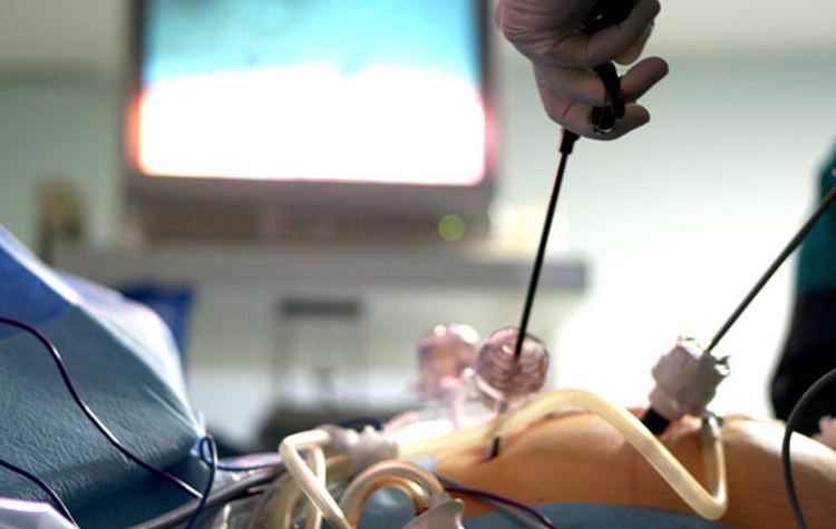 Kovid-19, Diyabetik hastalarda çok ağır seyrediyor 6