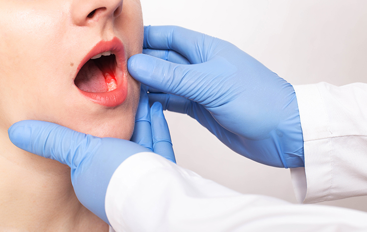 Diş eti kanaması ciddi sağlık sorunu habercisi olabilir! 6