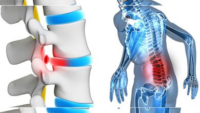 Bel fıtığı tedavisinde konforlu yöntem ! 9